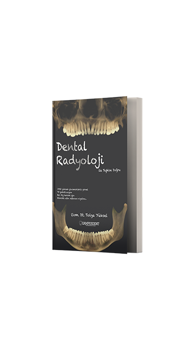 Dental Radyoloji ile Teşhise Doğru